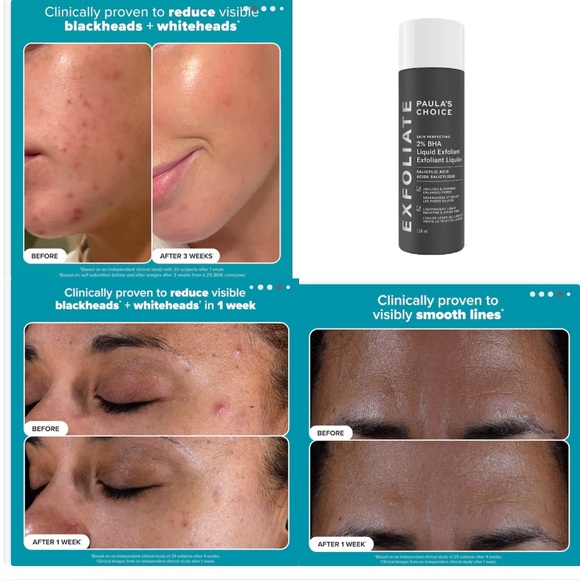 *🆕📦*BNIB* PAULA’S CHOICE |TRAVEL| TRIO BHA, MA/LA Exfoliant +Pro-Collagen serum - Picture 4 of 16